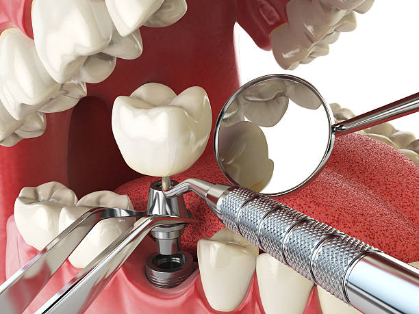 Best Walk-In Emergency Dentist in Rosedale, CA